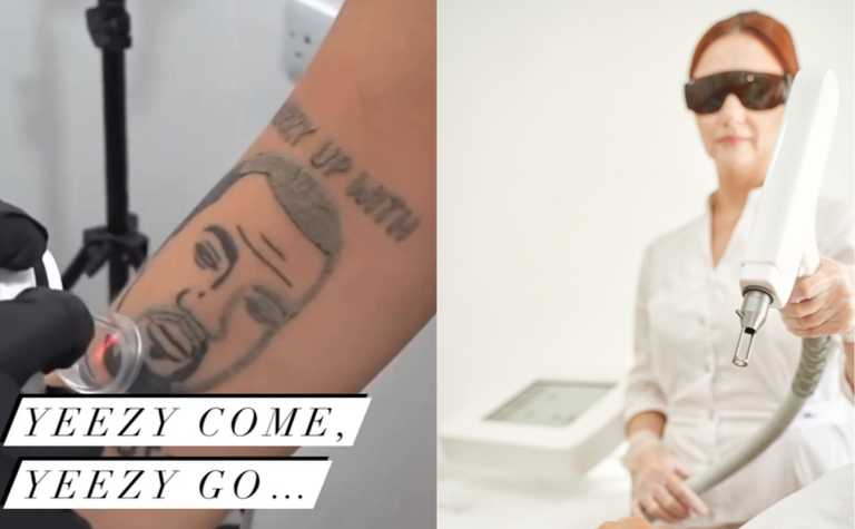 ‘Yeezy come, Yeezy go’ – London tattoo shop offering free removal of Kanye tats