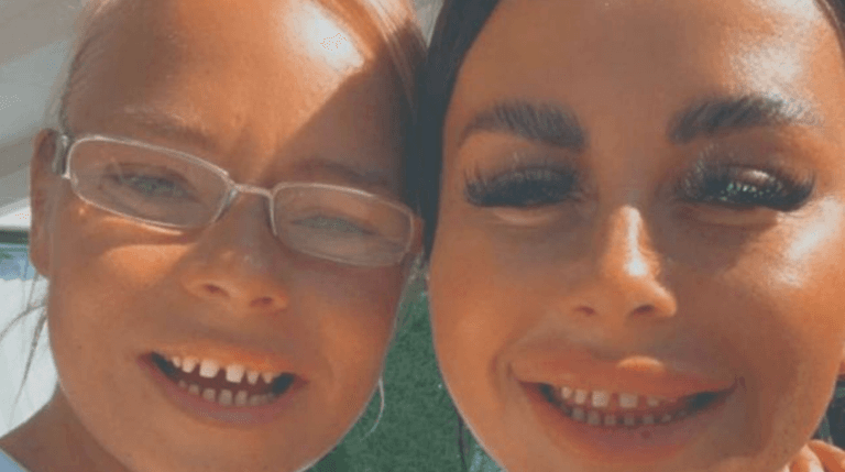 Couple unable to eat or drink following bloodbath ‘Turkey teeth’ procedure